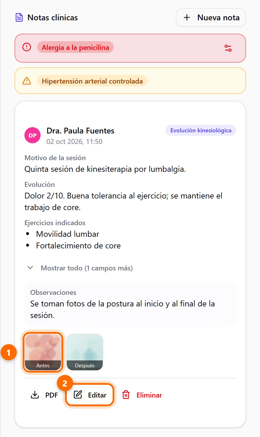 Nota clínica guardada con un checklist, dos fotos etiquetadas Antes y Después, y los botones PDF, Editar y Eliminar